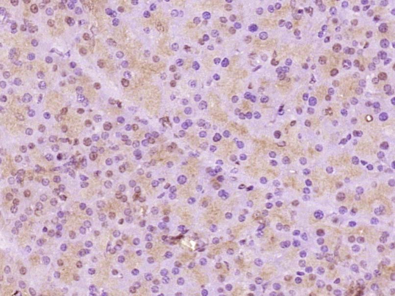 RSK3 Rabbit pAb(bs-3553R)-50ul