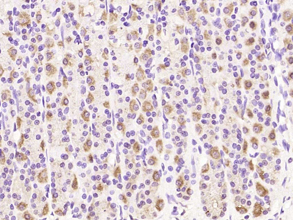 MRPL20 Rabbit pAb(bs-17779R)-5