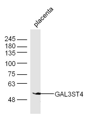 GAL3ST4 Rabbit pAb(bs-16215R)-