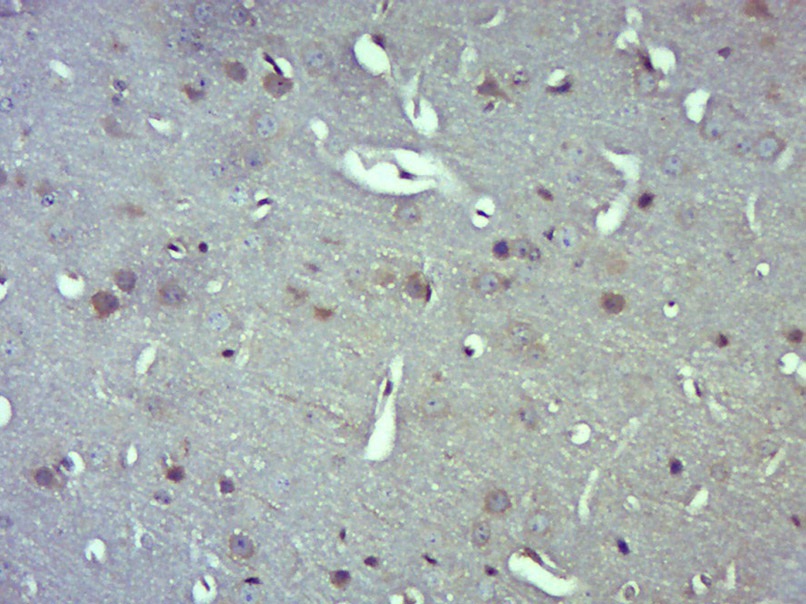 MRPL10 Rabbit pAb(bs-17768R)-5