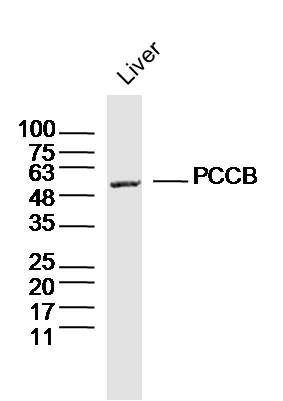 PCCB Rabbit pAb(bs-19910R)-50u