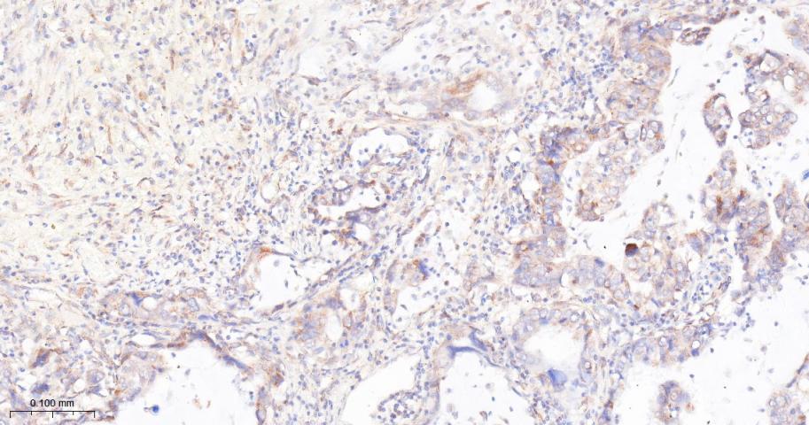 mTOR Recombinant Rabbit mAb(bs