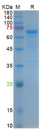 Recombinant SARS-Cov-2 N & RBD