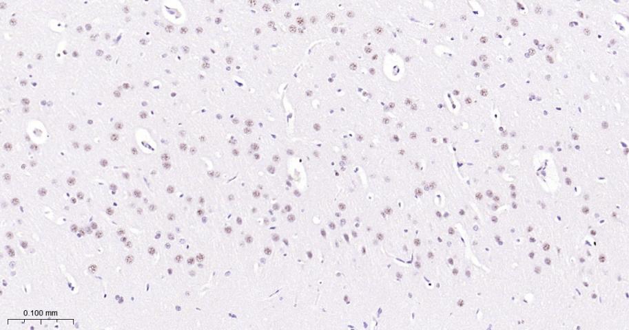 phospho-STAT3 (Tyr705) Mouse m
