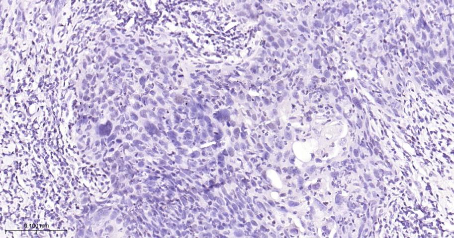 IRF2 Recombinant Rabbit mAb(bs