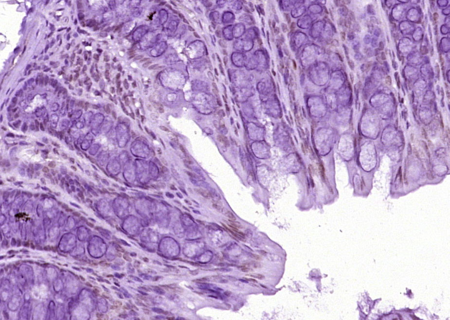 Histone H3 (mono methyl K9) Mo
