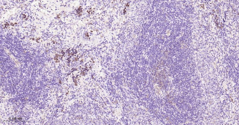 TYMS Recombinant Rabbit mAb(bs