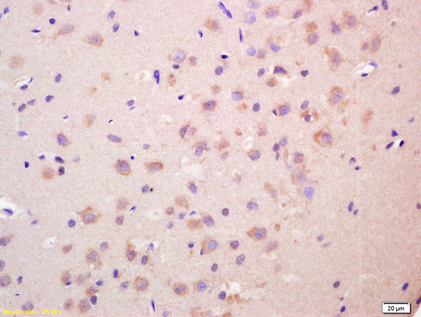 SECTM1 Rabbit pAb(bs-10153R)-5