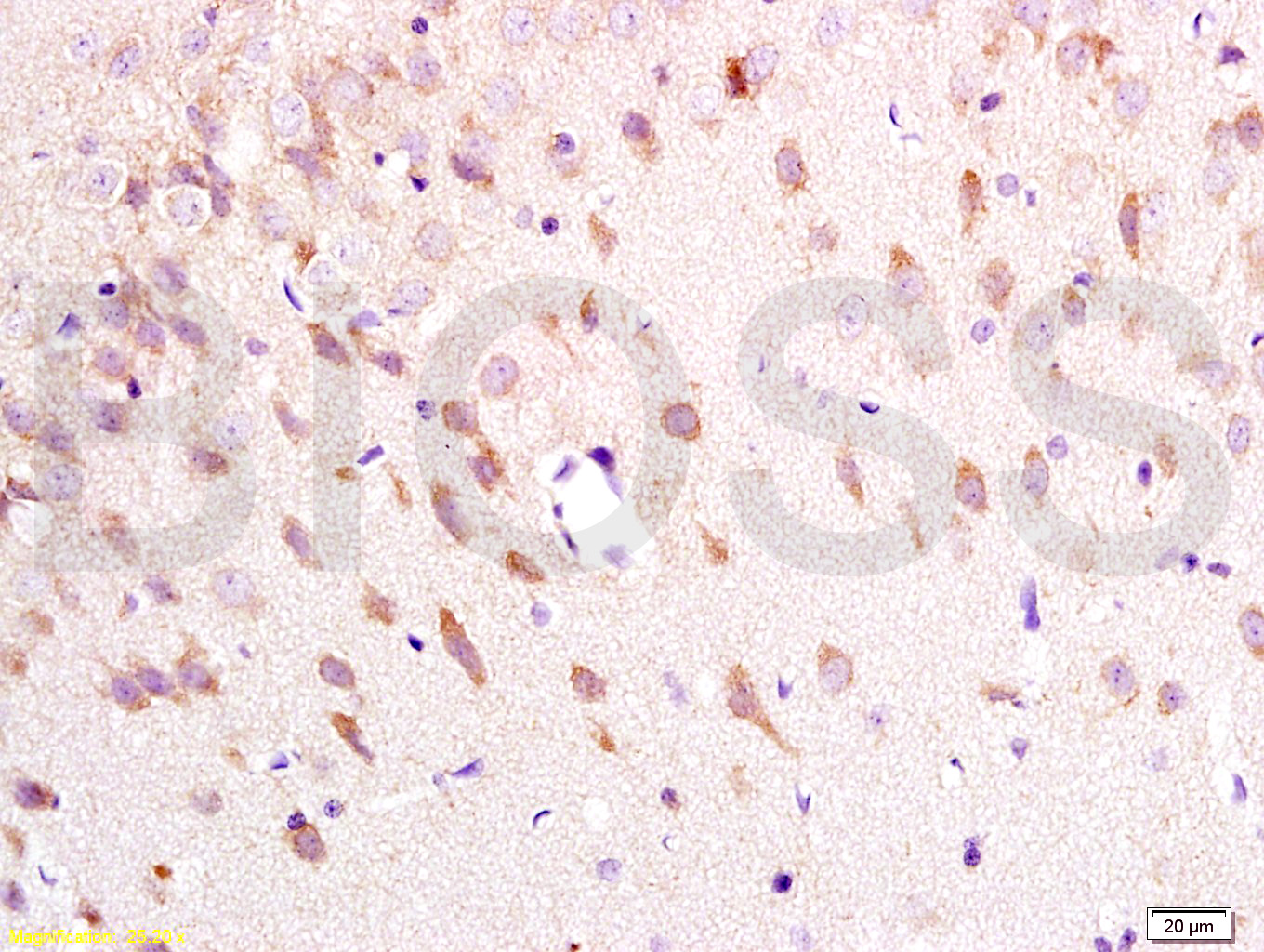 Neurokinin A Receptor Rabbit p