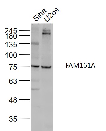 FAM161A Rabbit pAb(bs-8216R)-5