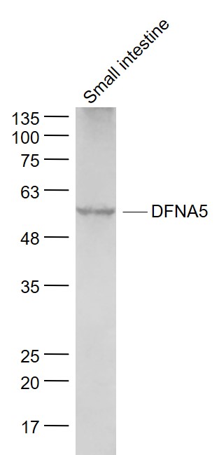 DFNA5 Rabbit pAb(bs-14286R)-50