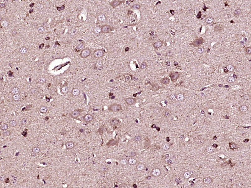 STIM1 Rabbit pAb(bs-8526R)-50u