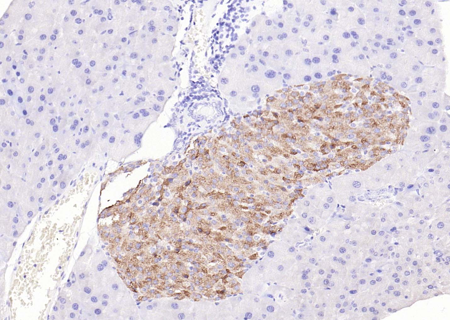 BMP8b Rabbit pAb(bs-3670R)-50u