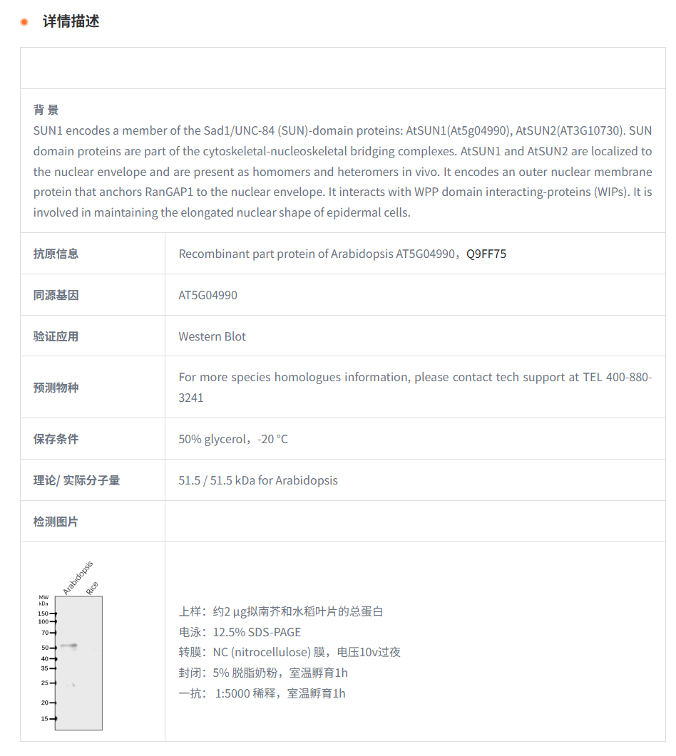 【植物抗体】Anti-SUN1/ SUN domain-co