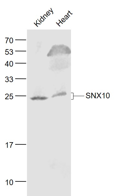 SNX10 Rabbit pAb(bs-12408R)-50