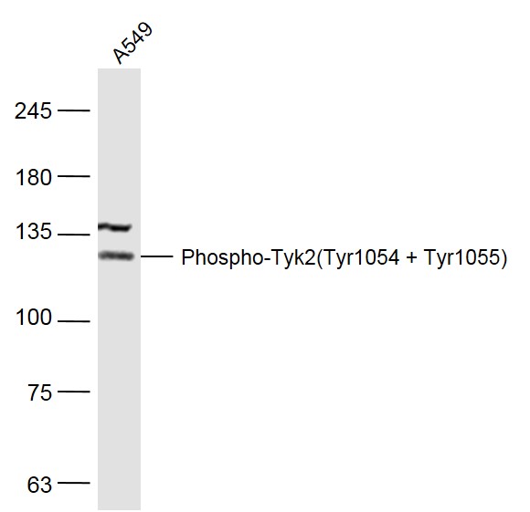 phospho-Tyk2 (Tyr1054 + Tyr105