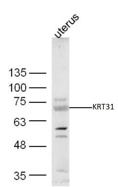 KRT31 Rabbit pAb(bs-23880R)-50