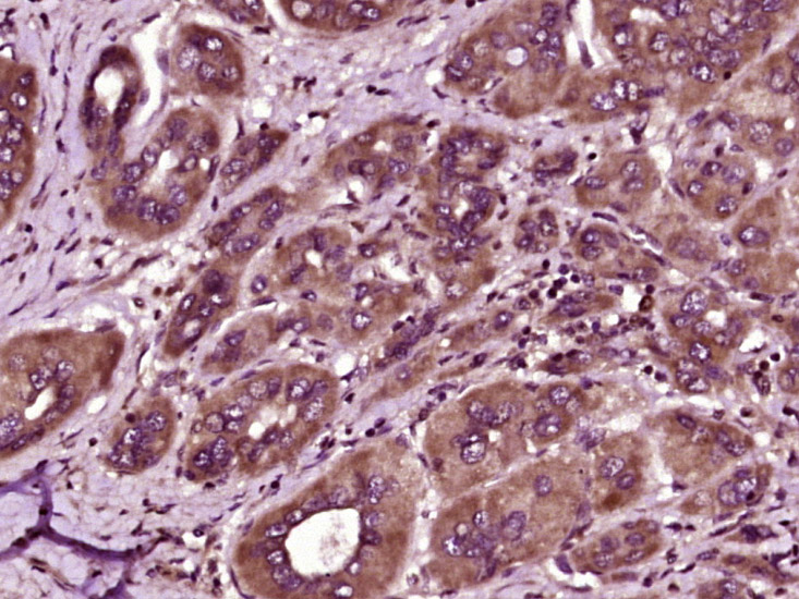 HAPLN1 Rabbit pAb(bs-15410R)-5