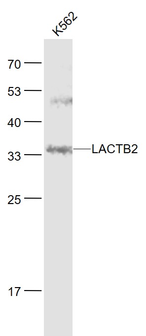 LACTB2 Rabbit pAb(bs-9561R)-50