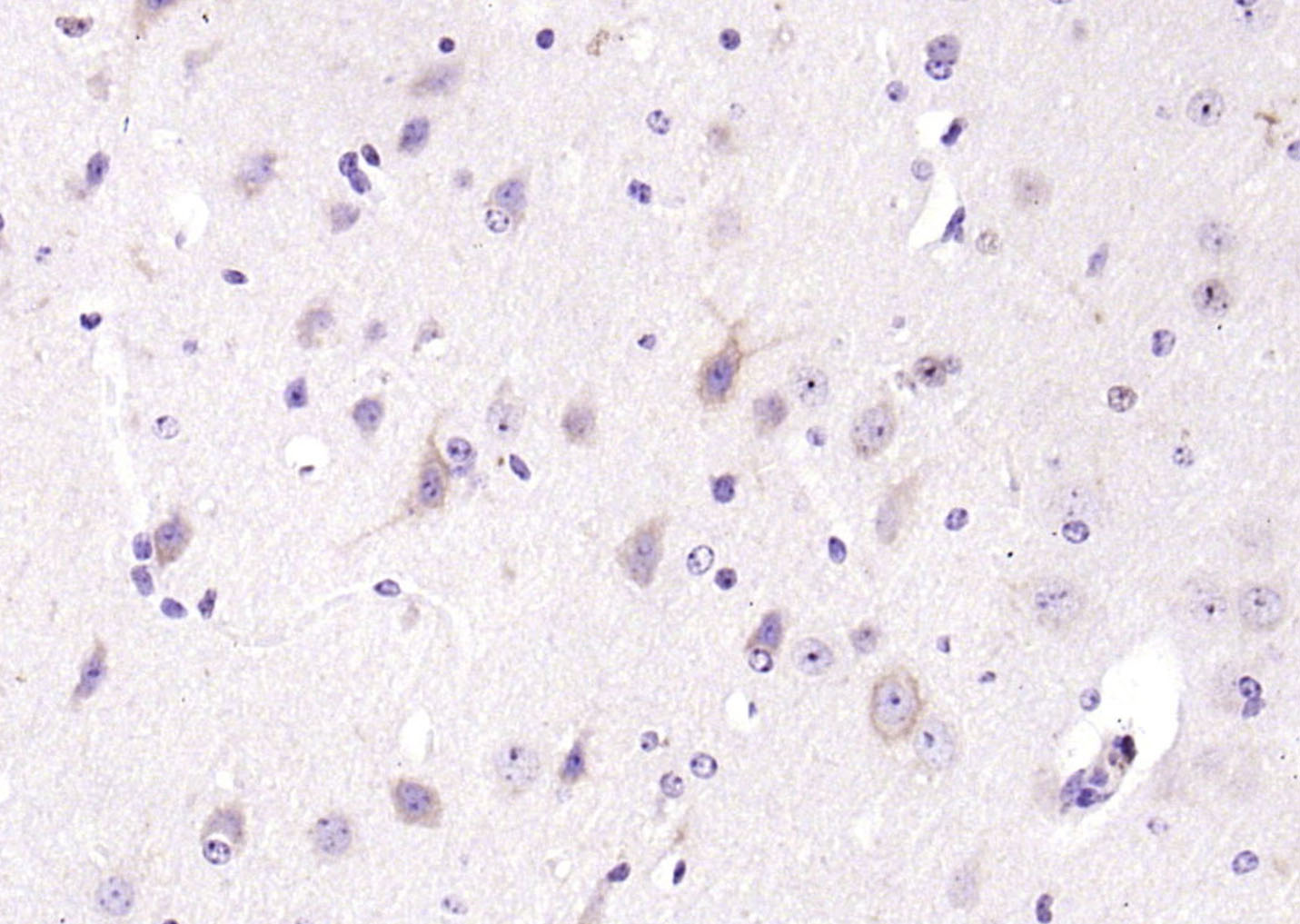 phospho-PLCG1 (Tyr771) Rabbit