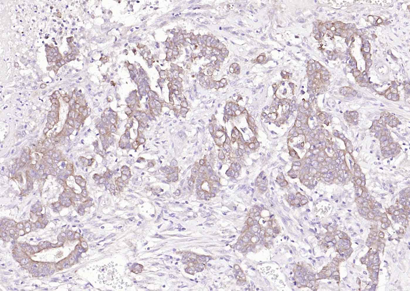 ACVRL1 Rabbit pAb(bs-6020R)-50