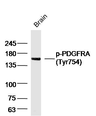 phospho-PDGFRA (Tyr754) Rabbit