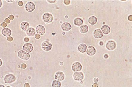 白细胞偏低：原因解析与应对策略