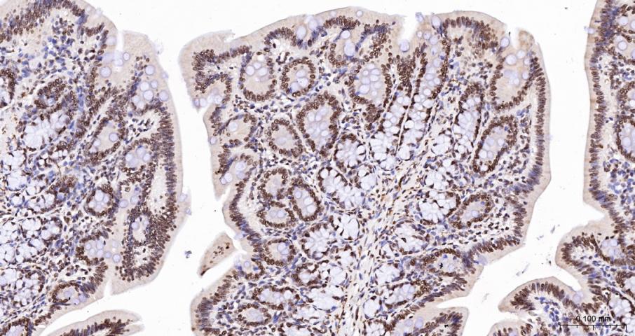 Histone H3(di methyl K27) Mous