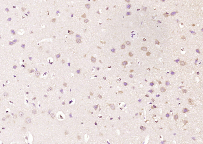 DLK1 Rabbit pAb(bs-4556R)-50ul