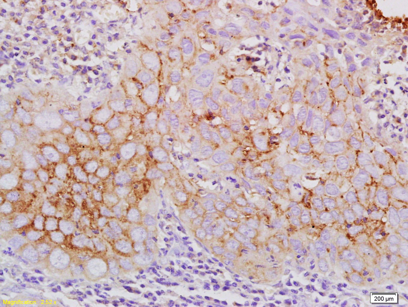 Claudin 10 Rabbit pAb(bs-13739