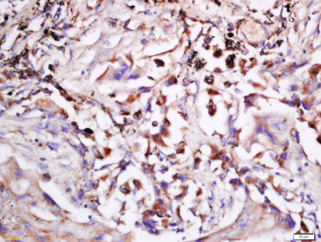 CTPS2 Rabbit pAb(bs-14101R)-50