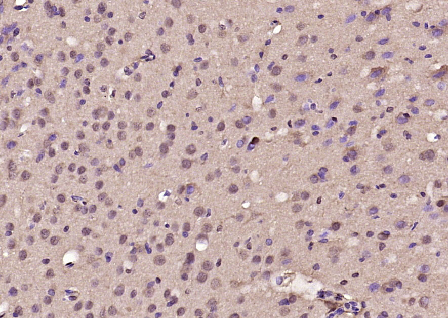 BTBD3 Rabbit pAb(bs-8397R)-50u