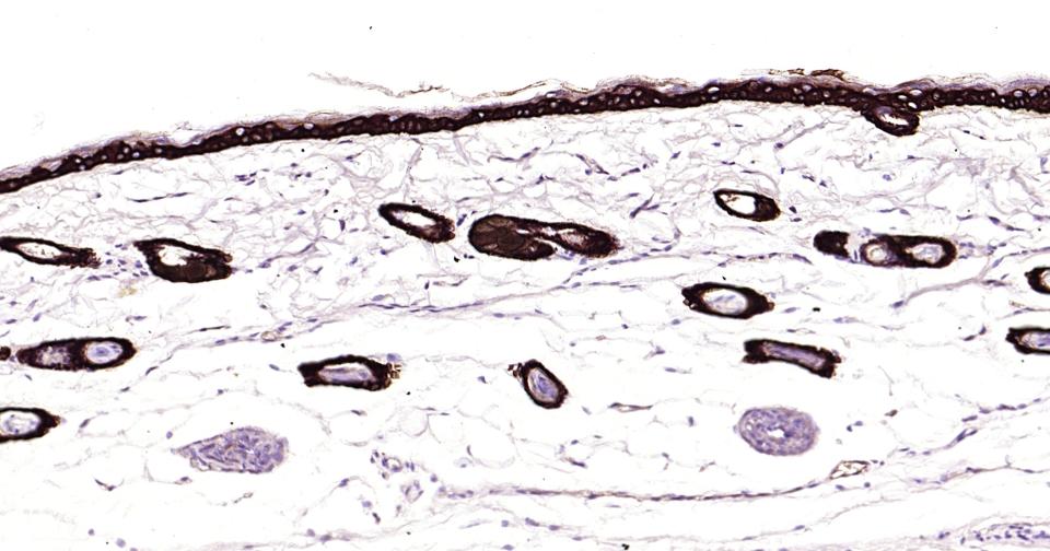 Cytokeratin 14 Recombinant Rab