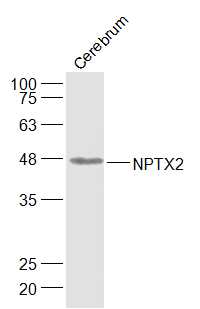 NPTX2 Rabbit pAb(bs-11017R)-50