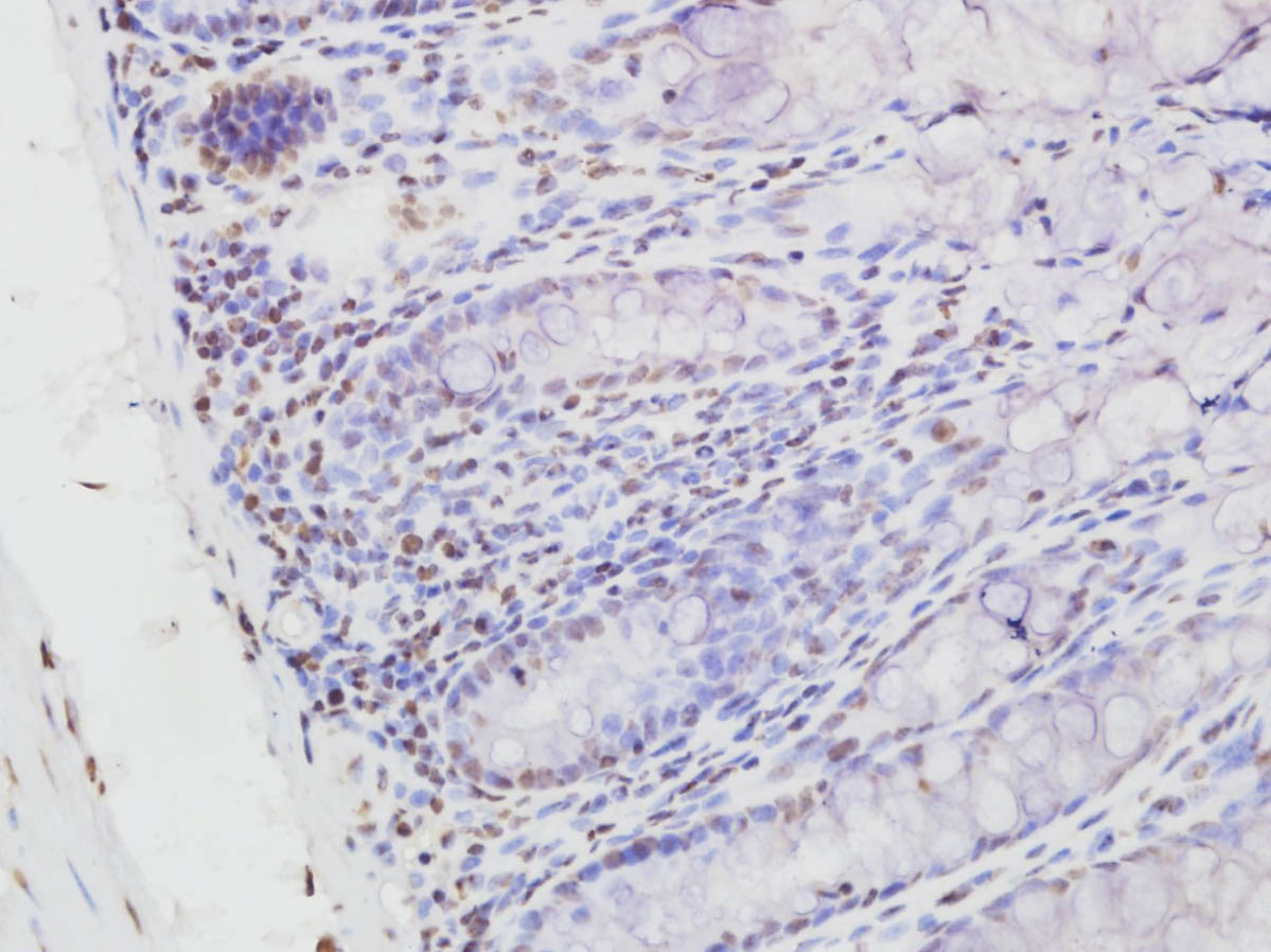 NFKB p65 (Acetyl-Lys314/Lys315