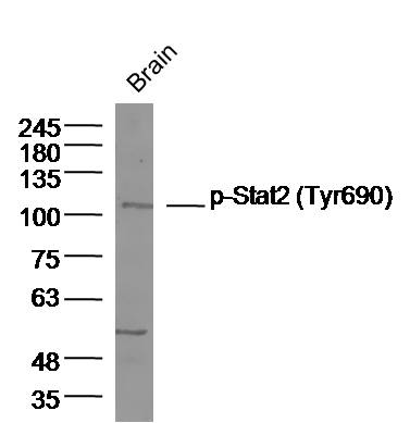 phospho-Stat2 (Tyr690) Rabbit 