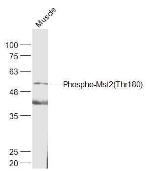 phospho-Mst2 (Thr180) Rabbit p
