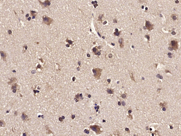 PIK3R2 Rabbit pAb(bs-4160R)-50