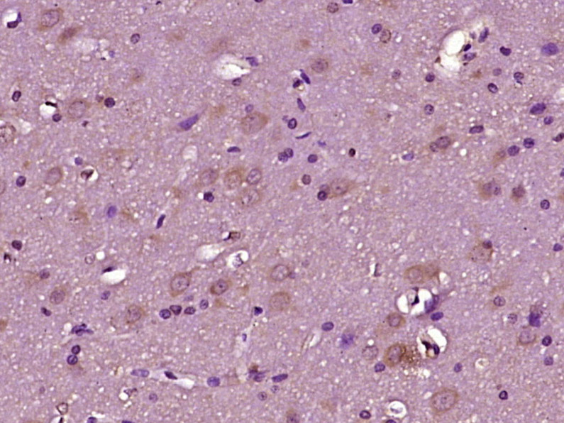 NRXN2 Rabbit pAb(bs-11104R)-50