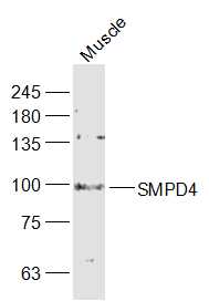 SMPD4 Rabbit pAb(bs-12641R)-50