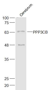 PPP3CB Rabbit pAb(bs-19972R)-5