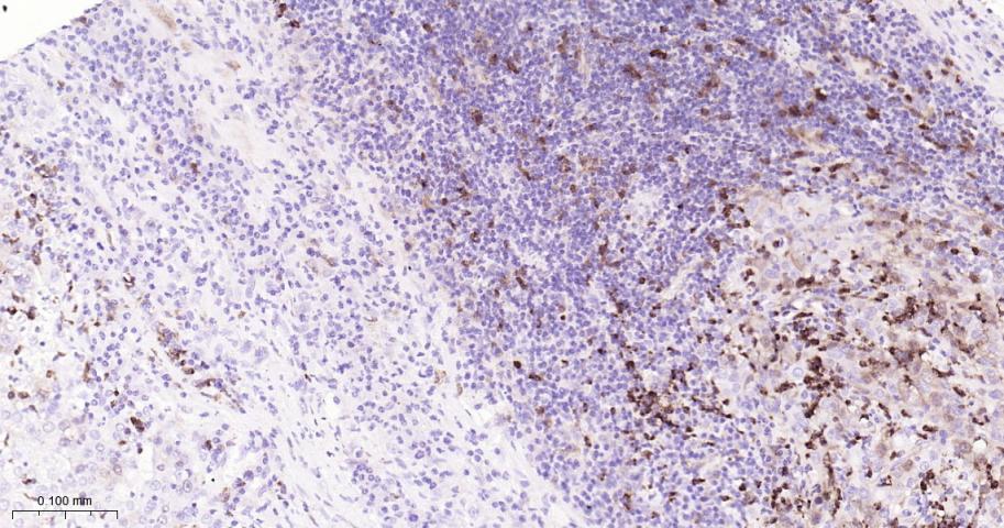 TYMS Recombinant Rabbit mAb(bs