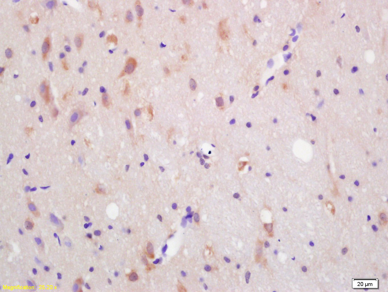 ACKR3 Rabbit pAb(bs-4897R)-50u