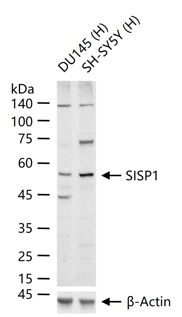 SISP1 Rabbit pAb(bs-9898R)-50u