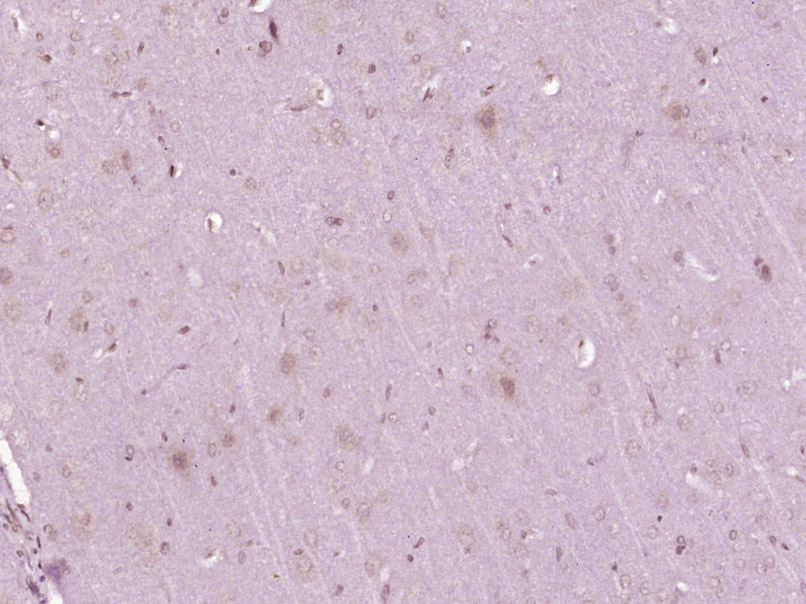 FRMD4A Rabbit pAb(bs-8235R)-50