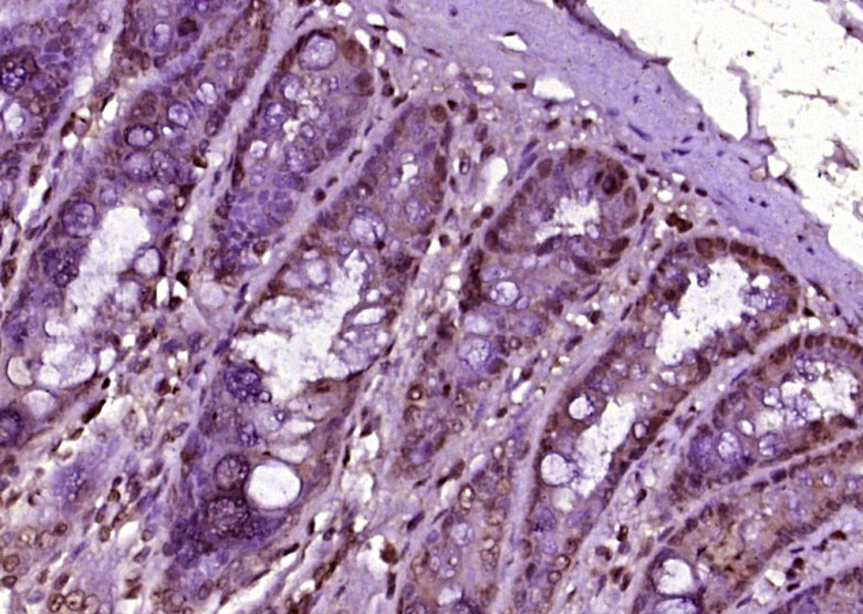 RPS6KB1 Rabbit pAb(bs-6370R)-5