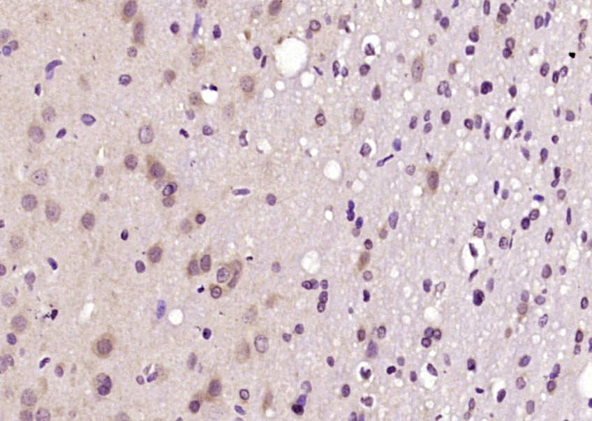 FEZ1 Rabbit pAb(bs-9721R)-50ul