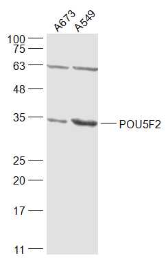 POU5F2 Rabbit pAb(bs-21048R)-5