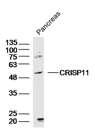 CRISP11 Rabbit pAb(bs-14061R)-