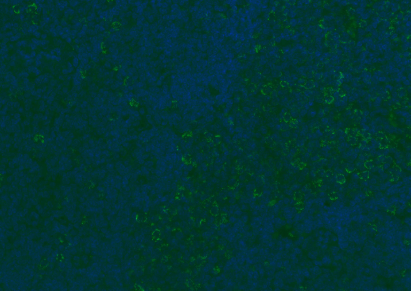 CD8B Rabbit pAb(bs-4914R)-50ul